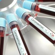 Moderna Stock Surges After U.S. Pharmaceutical Company Develops Coronavirus Vaccine
