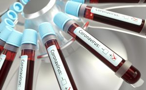 Moderna Stock Surges After U.S. Pharmaceutical Company Develops Coronavirus Vaccine